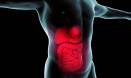 New drug for IBS