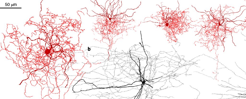 Scientists Have Found a New Type of Brain Cell And It Looks Like It's ...