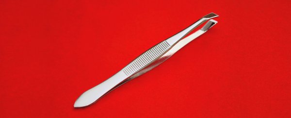 A man had 3-inch-long tweezers stuck inside his penis for 4 whole years