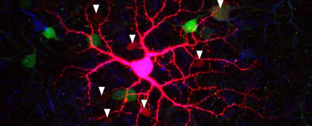 A mouse retina and an ipRGC. 