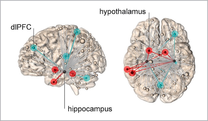 010 stress brain 1