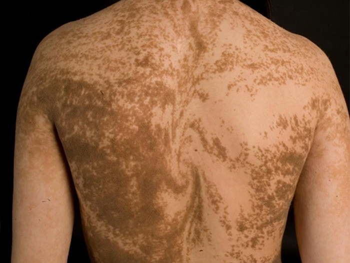 Humans Actually Have Secret Stripes And Other Strange Markings