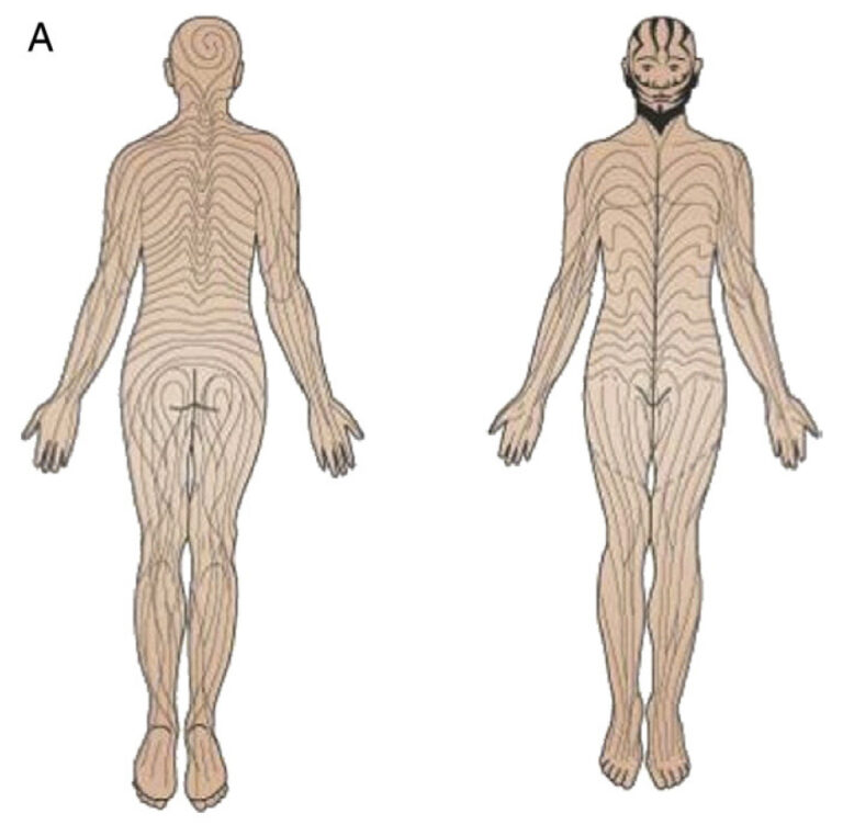 humans-actually-have-secret-stripes-and-other-strange-markings