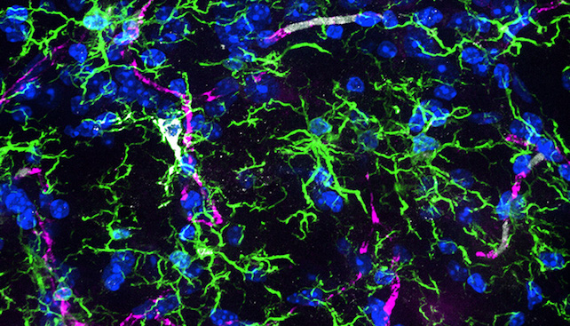 microglia in an aging mouse brain