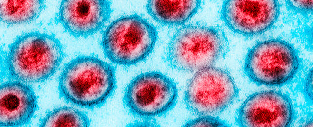 red HIV particles on a blue background