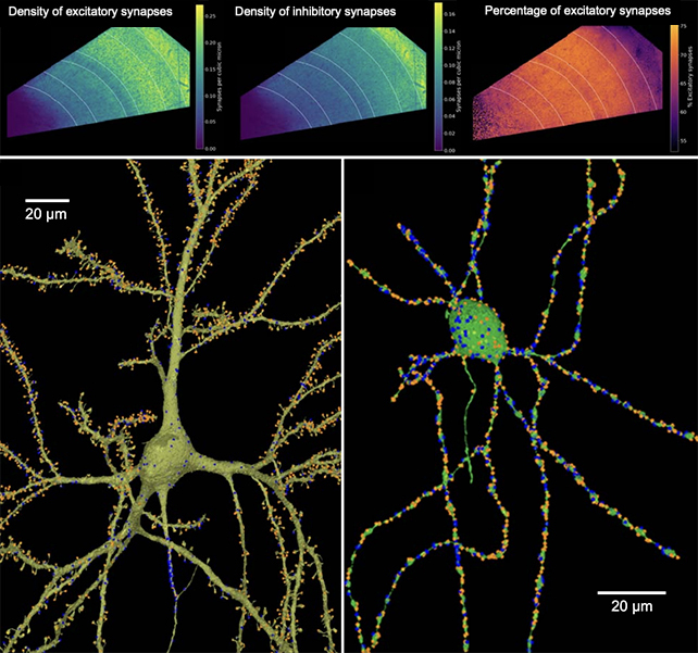 Pictures of neurons on black