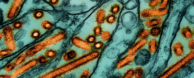 transmission electron micrograph of bird flu virus particles in orange in green kidney cells