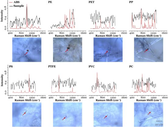 Experiment Reveals Microplastics In Every Human Semen Sample Tested ...