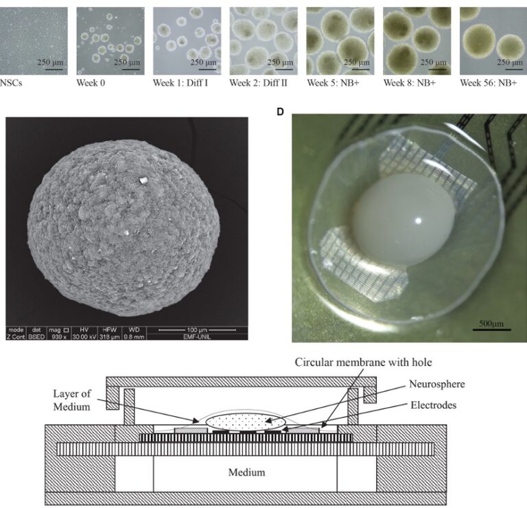 swiss-startup-connects-16-human-mini-brains-to-create-low-energy