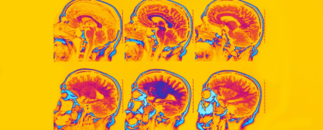 Six colourful brain scans on a yellow background