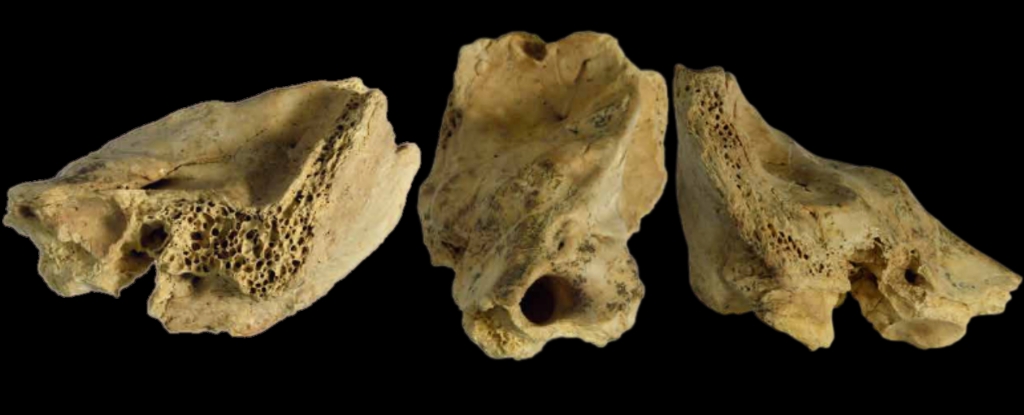 Hueso fosilizado de neandertal con ‘síndrome de Down’ desafía las ideas de cuidado prehistórico: Heaven32