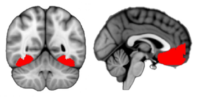 Régions du cerveau