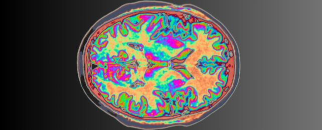 A bright colored scan of a brain