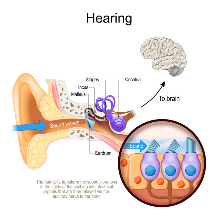 Diagram of ear anatomy including a close up of the hairs in the cochlea