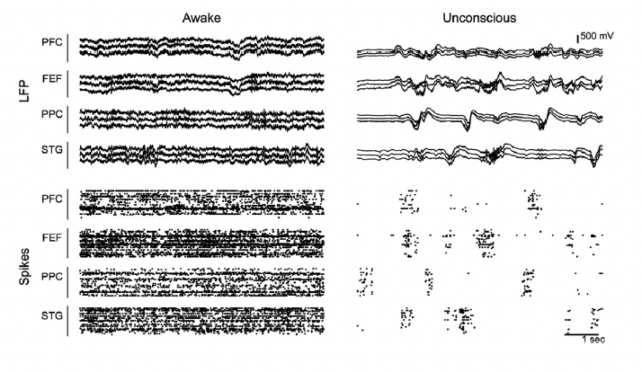 Panel showing sample of brain activity data collected from awake and unconscious animals. 