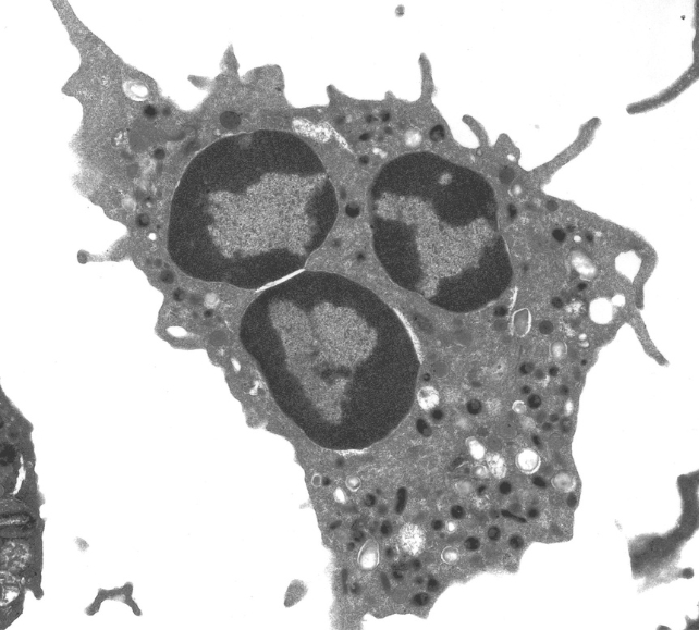 A black and white image of a splodge with three darker circle sections 