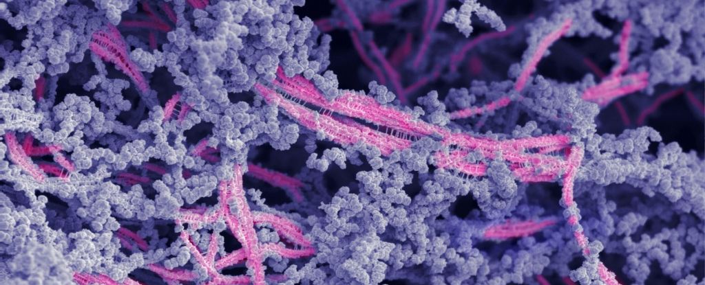 Un nuevo biomaterial finalmente puede ayudar a reparar el cartílago dañado en las articulaciones afectadas: ScienceAlert