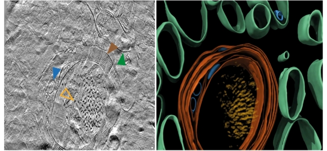 A grey scan next to a colored image showing molecules inside brain tissue