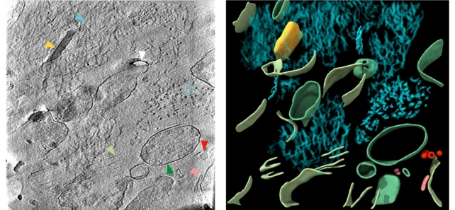 A grey scan next to a colored image showing molecules inside brain tissue