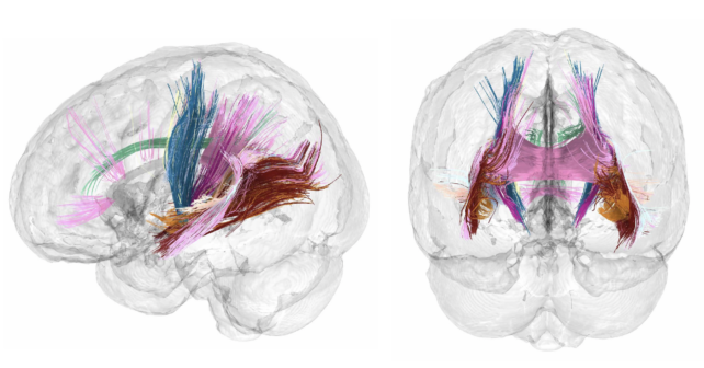 Brain Connectivity MRI