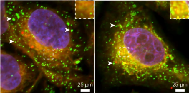 Feature Media Green dots are lipid droplets Bellen Goodman NatGen Aug 2024 1