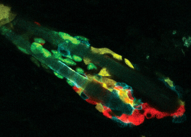 Useless Cells Are Cleared From The Frame in a Strangely Cannibalistic Method