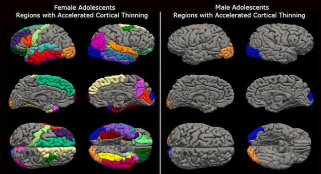 COVID-19 Lockdowns Upfront Elderly Youngsters’ Brains, Learn about Reveals