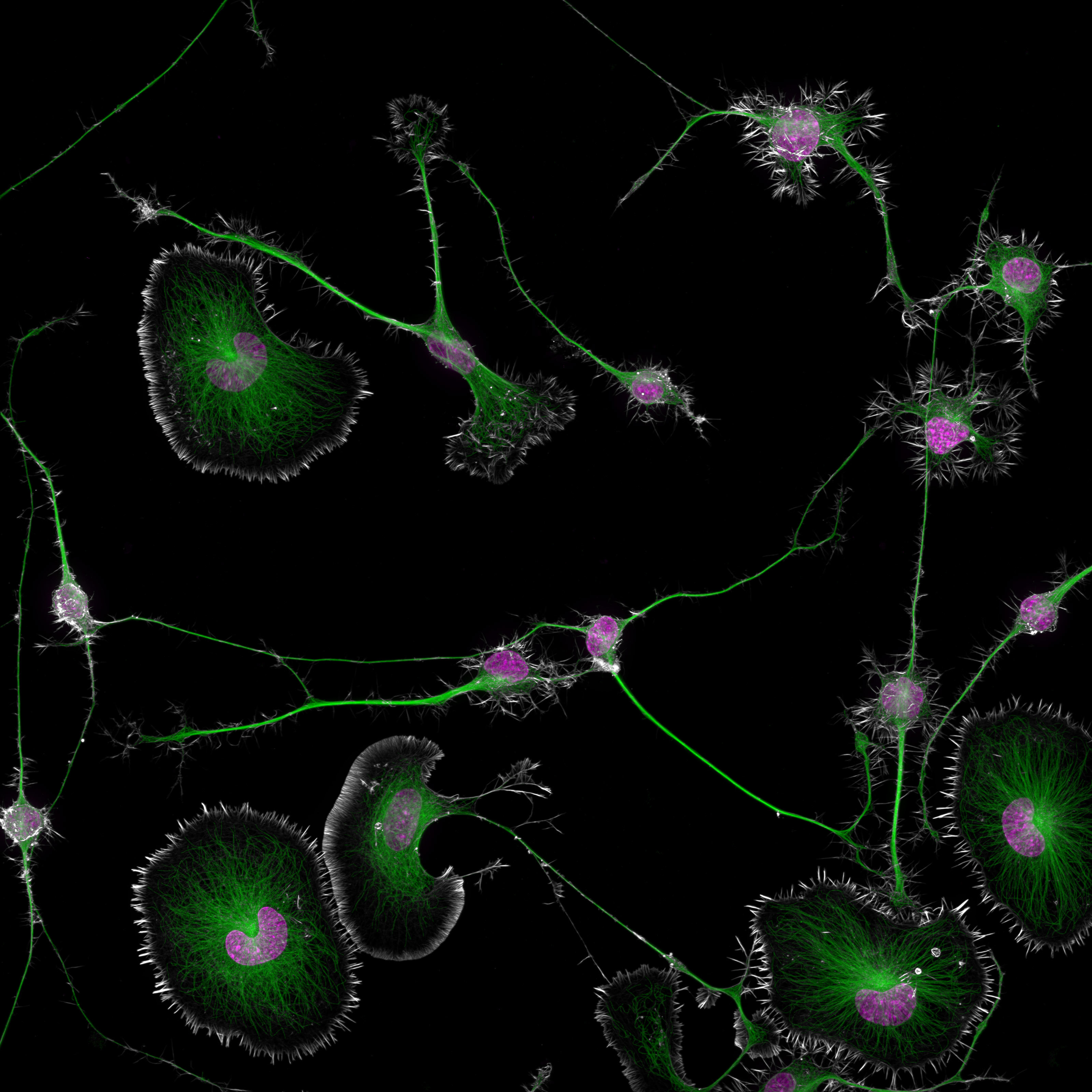 Award Winning Image Holds Insights Into Dementia in Nikon's Stunning Microscopy Competition