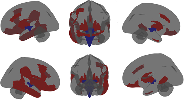 Brain differences