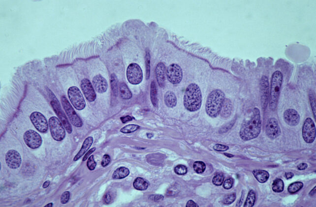 Cilia Fallopian Tube