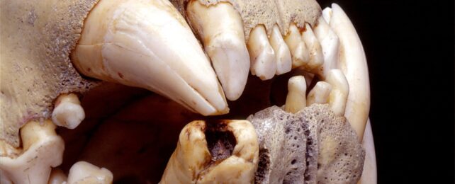 A close up of huge, deteriorating teeth