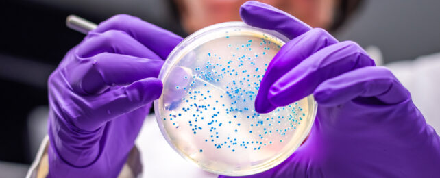 e coli on an agar plate