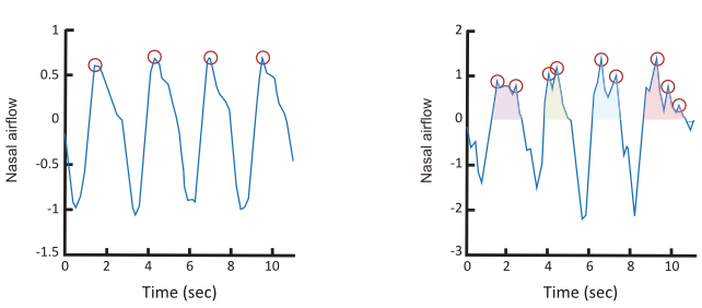 graph of anosmic vs normosmic inhalations