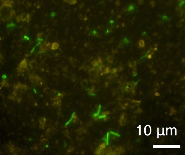 Microbes Found Alive Sealed in Rock For 2 Billion Years - blog ...