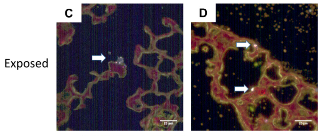 plastics in mouse lungs