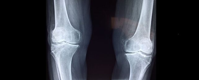 Detailed knee bone xrays