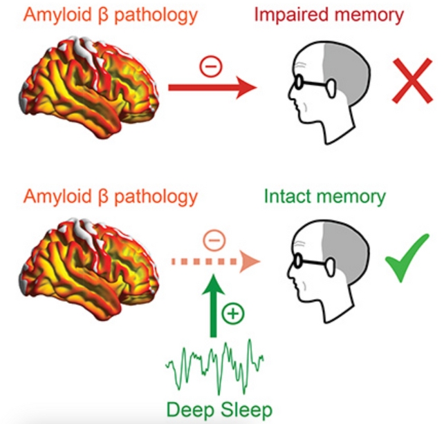 Illustration of Brains 