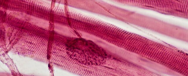 Pink striated muscle fibers with blobby nerve connections