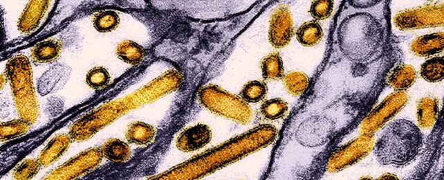 Micrograph showing yellow rod and sphere virus particles in purple kidney tissue