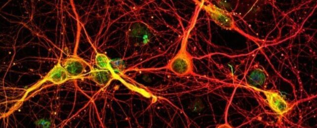 Microscope image of neurons from a mouse's cortex colored in red yellow and green