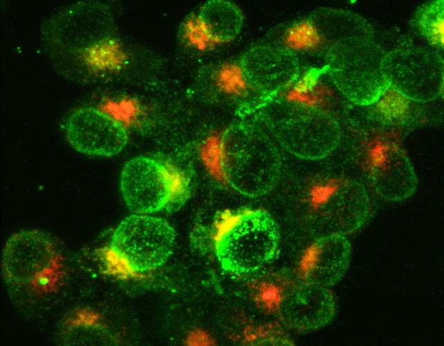 Bright green cells with orange spots in between them