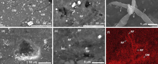 microscopic Bacteria images on Asteroid Sample