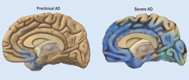 This Animal Can Shrink Its Mind, And We After all Know How