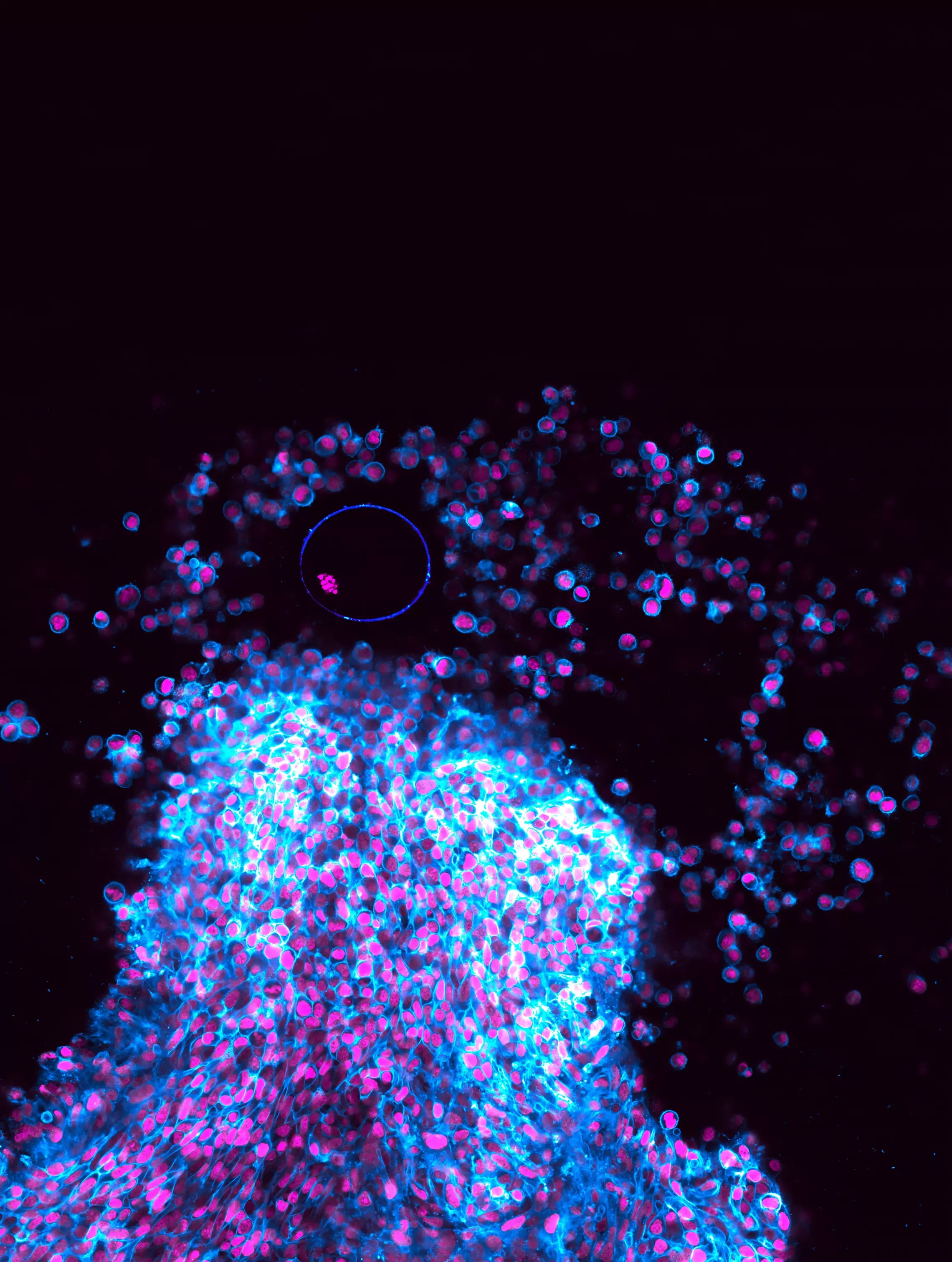 a microscope image, black background with a volcano-like cluster of fluorescent blue cells with little pink dots of DNA inside protruding from the bottom of the image. in the black space above this mound, some cells float freely in the dark, along with one large, round cell - the egg.