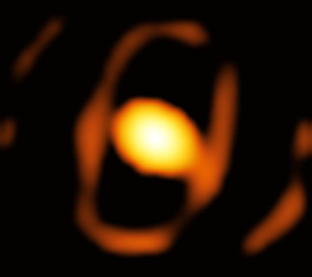 This Weird-Ass Blob Is The First Close-Up Picture of a Star Outside The Milky Way