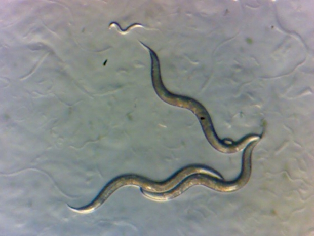 Nematodes under a microscope