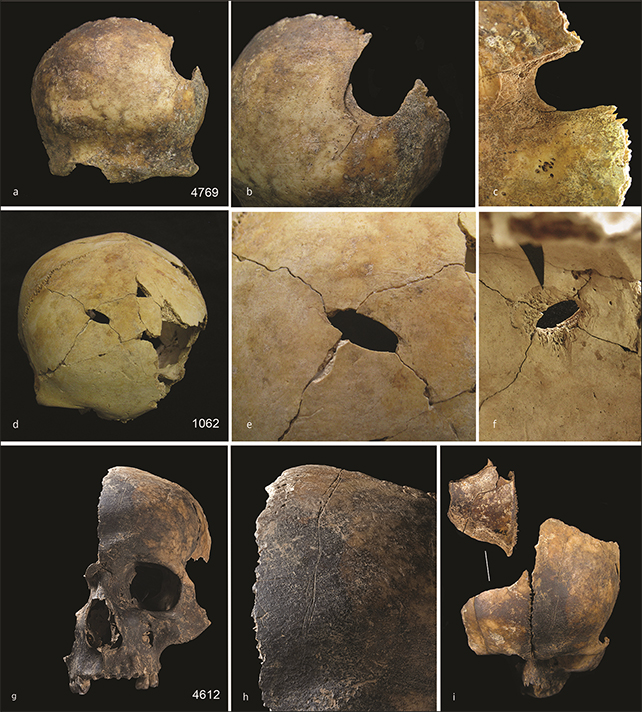 Cranial trauma