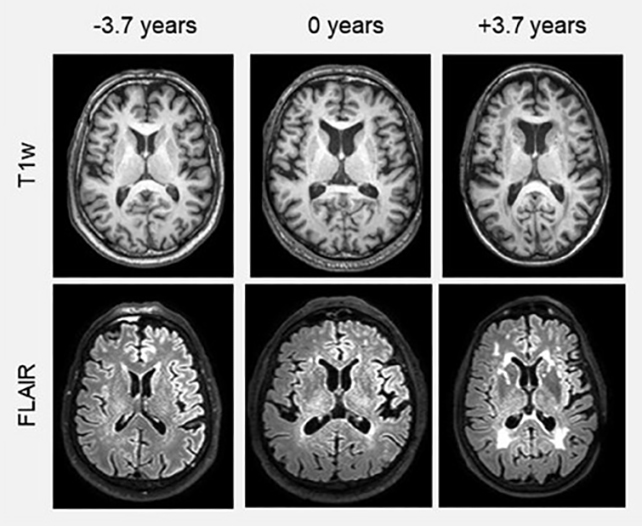 These Habits Can Keep Your Brain Looking Young at 70 : ScienceAlert