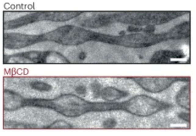 Cholesterol Removal Neurons