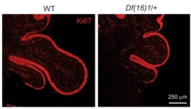 Microscope image showing larger brain lobes on the left image compared to the right